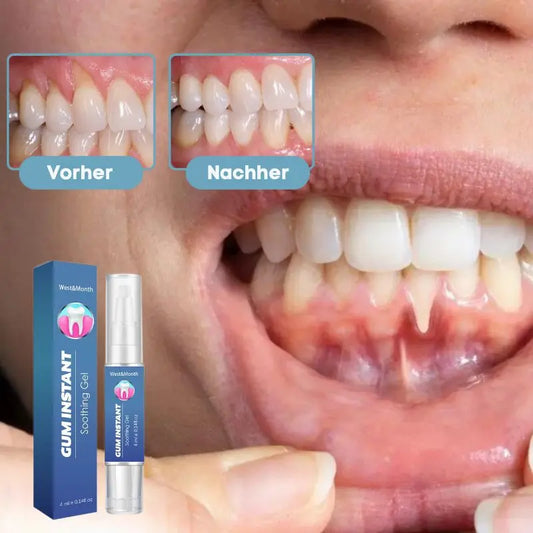 ZahnVital™ Sofort-Zahnfleischreperatur Gel