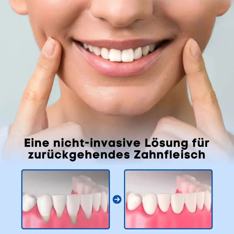 ZahnVital™ Sofort-Zahnfleischreperatur Gel
