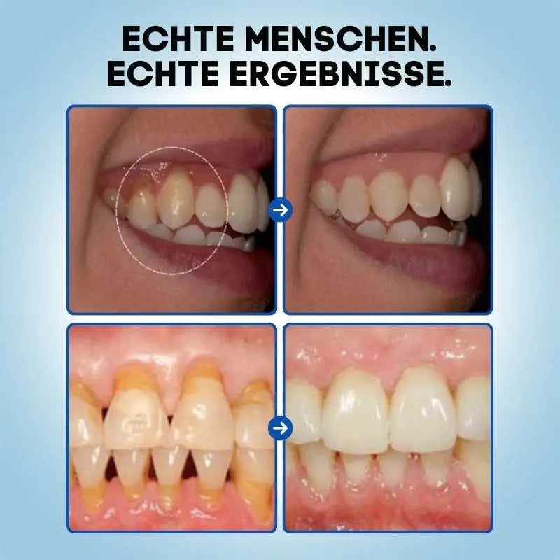 ZahnVital™ Sofort-Zahnfleischreperatur Gel