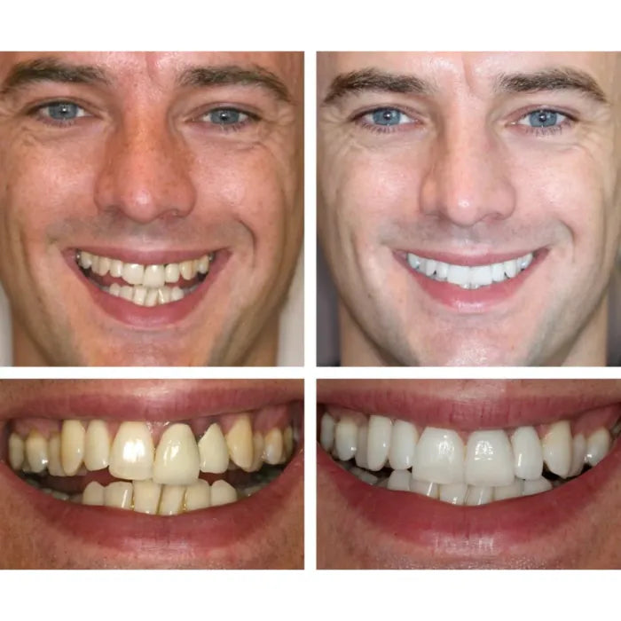 ZahnVital™ Sofort-Zahnfleischreperatur Gel