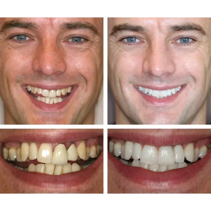 ZahnVital™ Sofort-Zahnfleischreperatur Gel