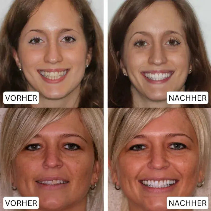 ZahnVital™ Sofort-Zahnfleischreperatur Gel